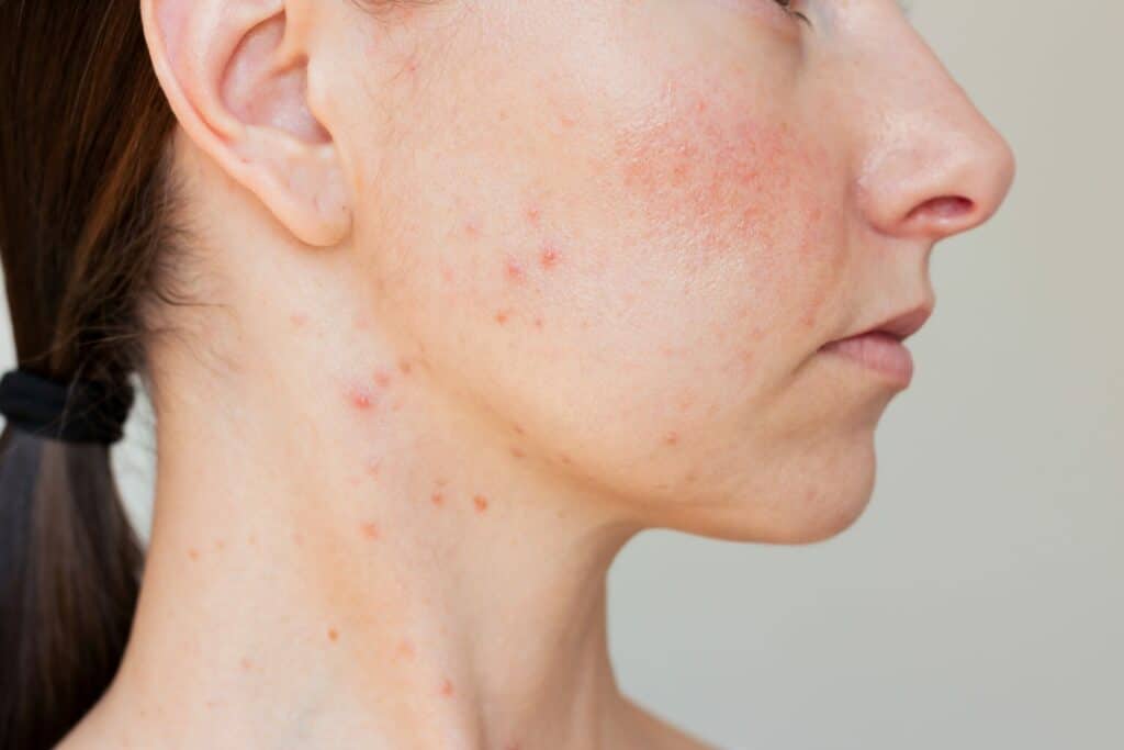 Top 8 Most Common Skin Conditions and Their Treatments